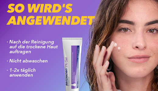 BENZAKNEN %5 jel, 40 g