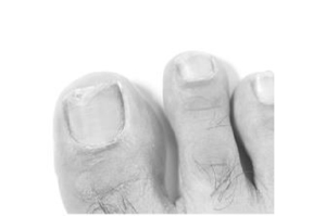 [1a Pharma Nagell.g.Nagelpilz 78,22mg/ml, 6,6 ml