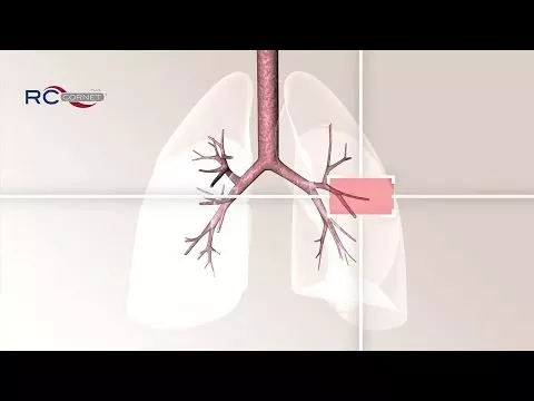 RC Kornet Plus, 1 adet hakkında video