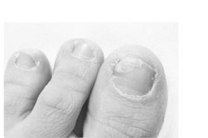 [1a Pharma Nagell.g.Nagelpilz 78,22mg/ml, 6,6 ml