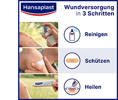 HANSAPLAST elastik sabitleme bandı krepli 8 cmx4 m, 1 adet