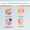 EndWarts® CLASSIC solüsyonu, 3 ml